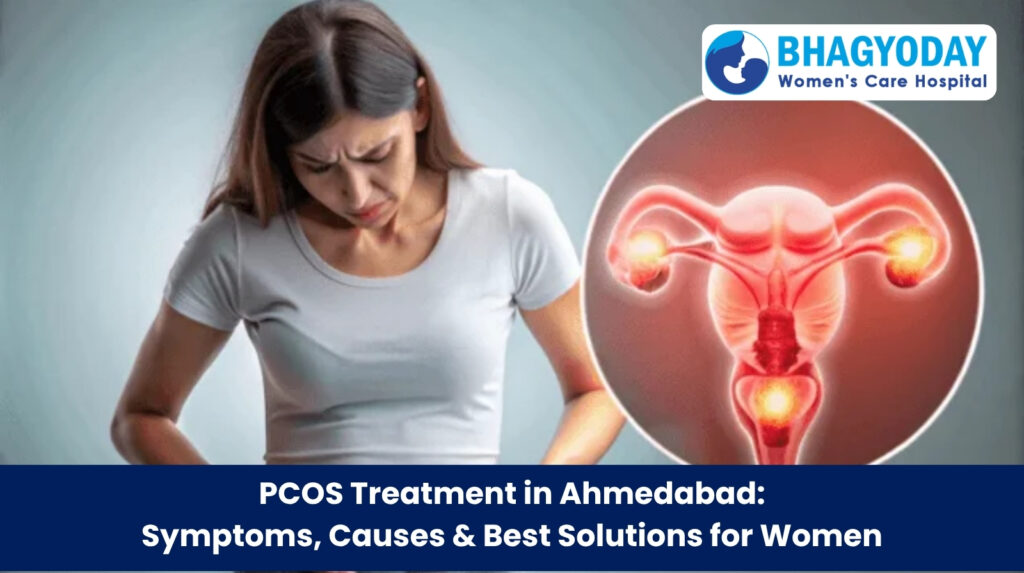 PCOS treatment in Ahmedabad